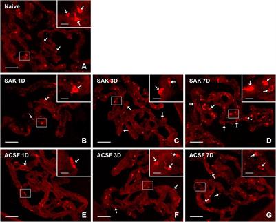 Subarachnoid Hemorrhage Induces Dynamic Immune Cell Reactions in the Choroid Plexus